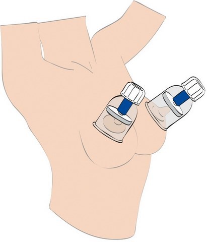 Pompes à tétons - Suction Cups - ​Max Twist